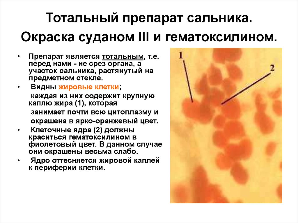 Мезотелий сальника препарат гистология