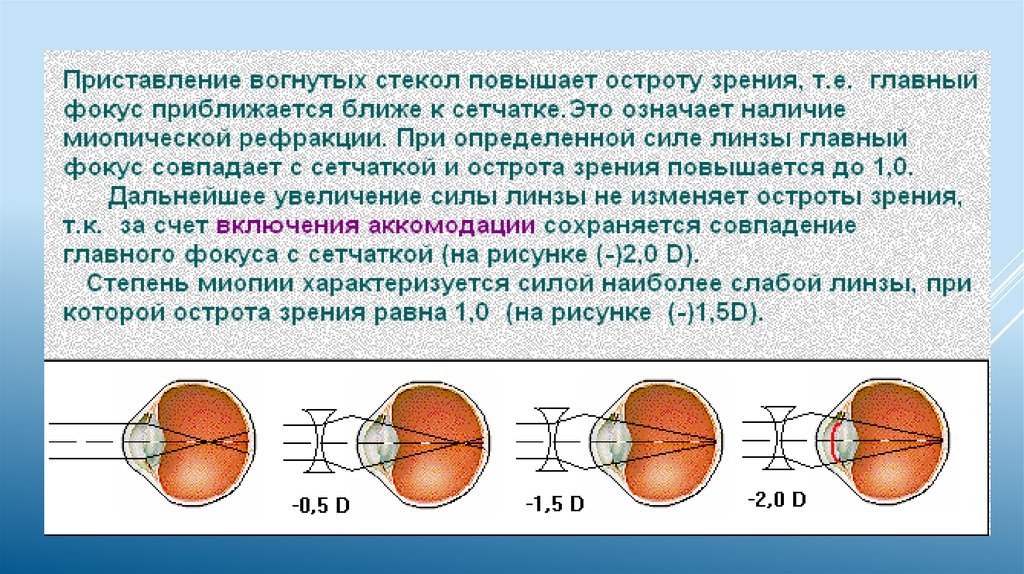 Острота зрения больше при фокусировке изображения