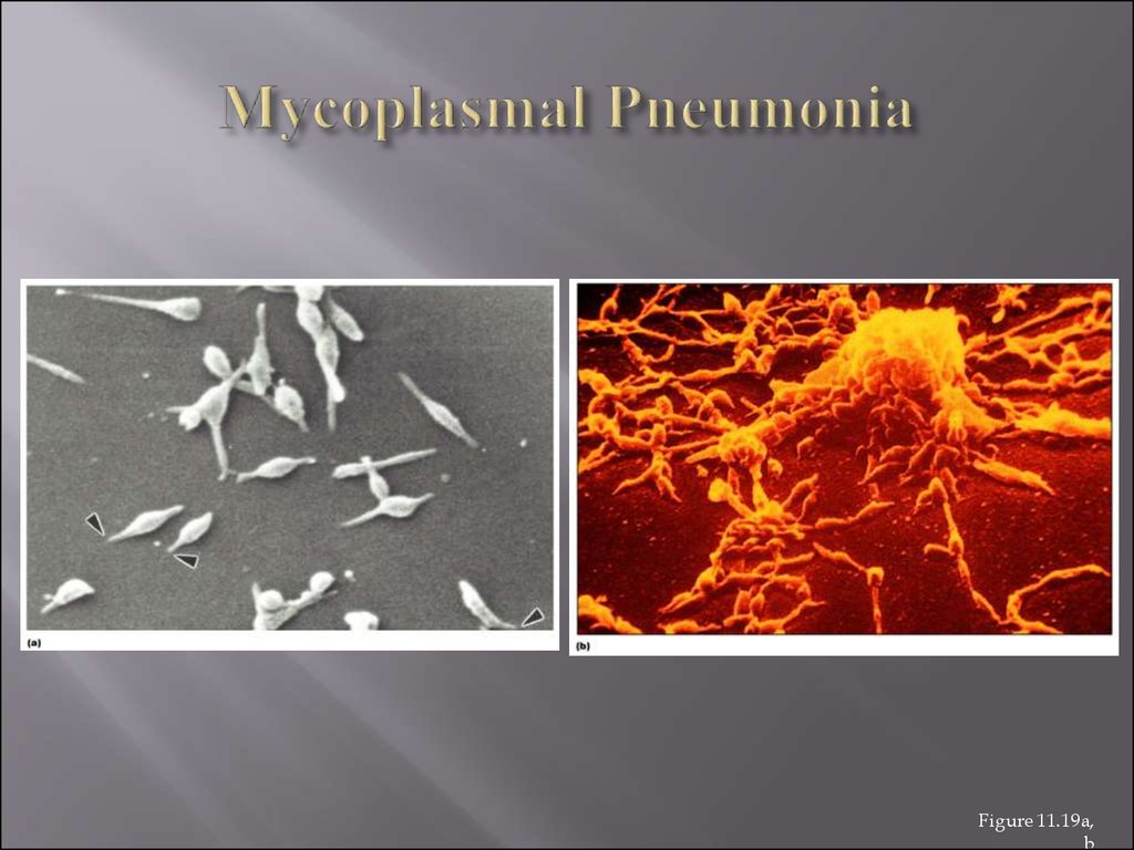 Mycoplasma pneumoniae