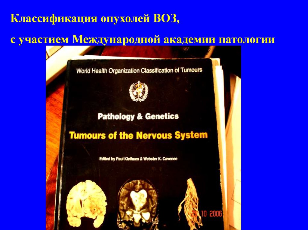 Воз рак. Классификация опухолей воз. Международная классификация опухолей воз. Классификация опухолей по воз 2016. Тератома классификация воз.