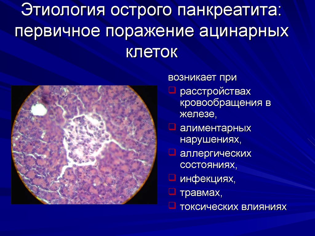 Поражения клеток. Этиология поджелудочной железы. Ацинарные клетки поджелудочной железы. Острый панкреатит этиология. Панкреатит этиология.