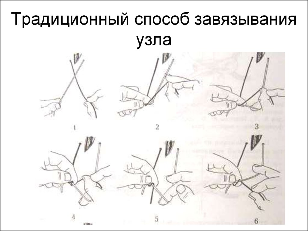 Классический способ. Завязывание узла шов. Классический способ завязывания хирургического узла. Классический способ формирования простого узла. Техника завязывания женского узла.