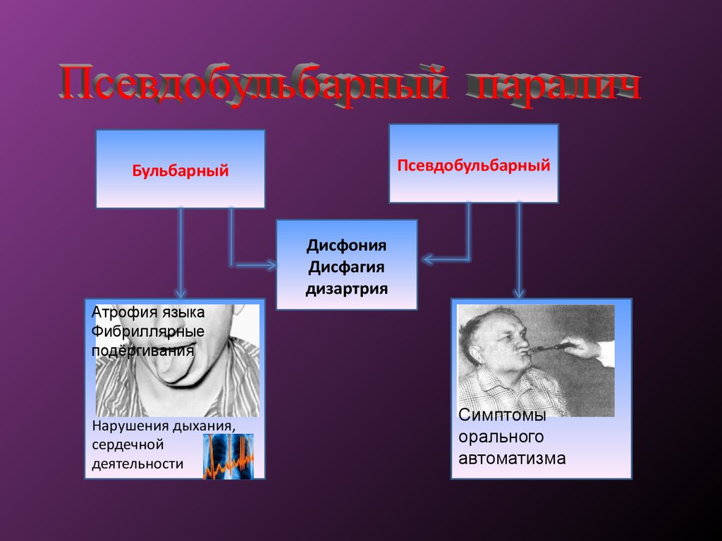 Общая симптоматология нервных болезней презентация