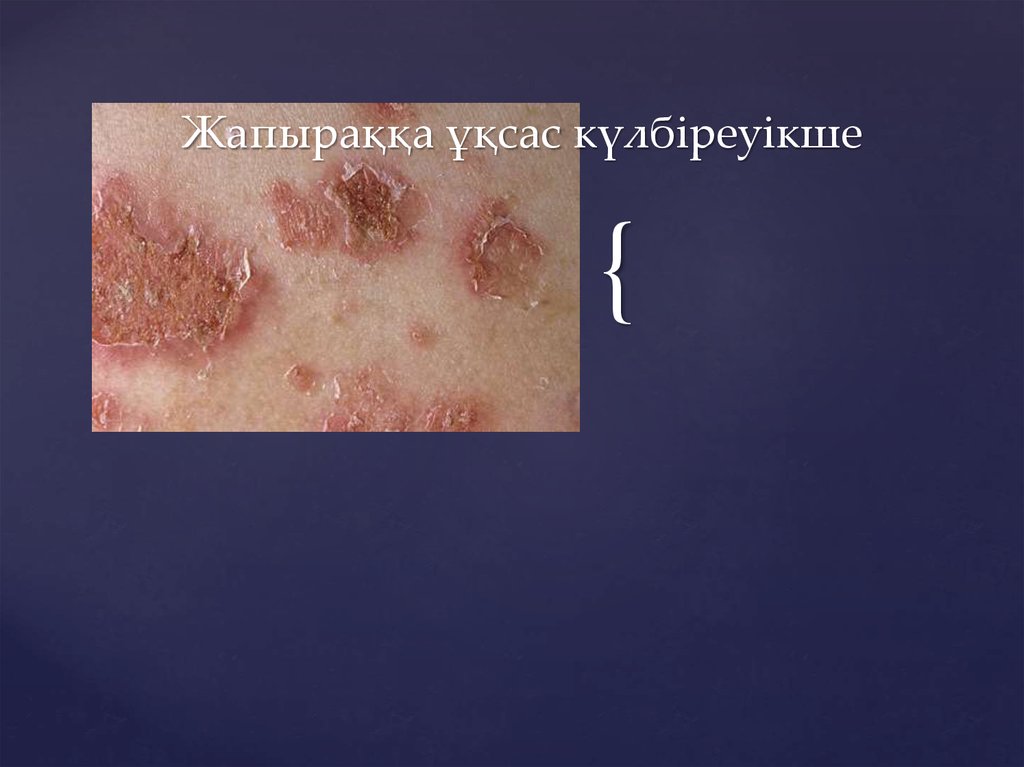 Жапыраққа ұқсас күлбіреуікше