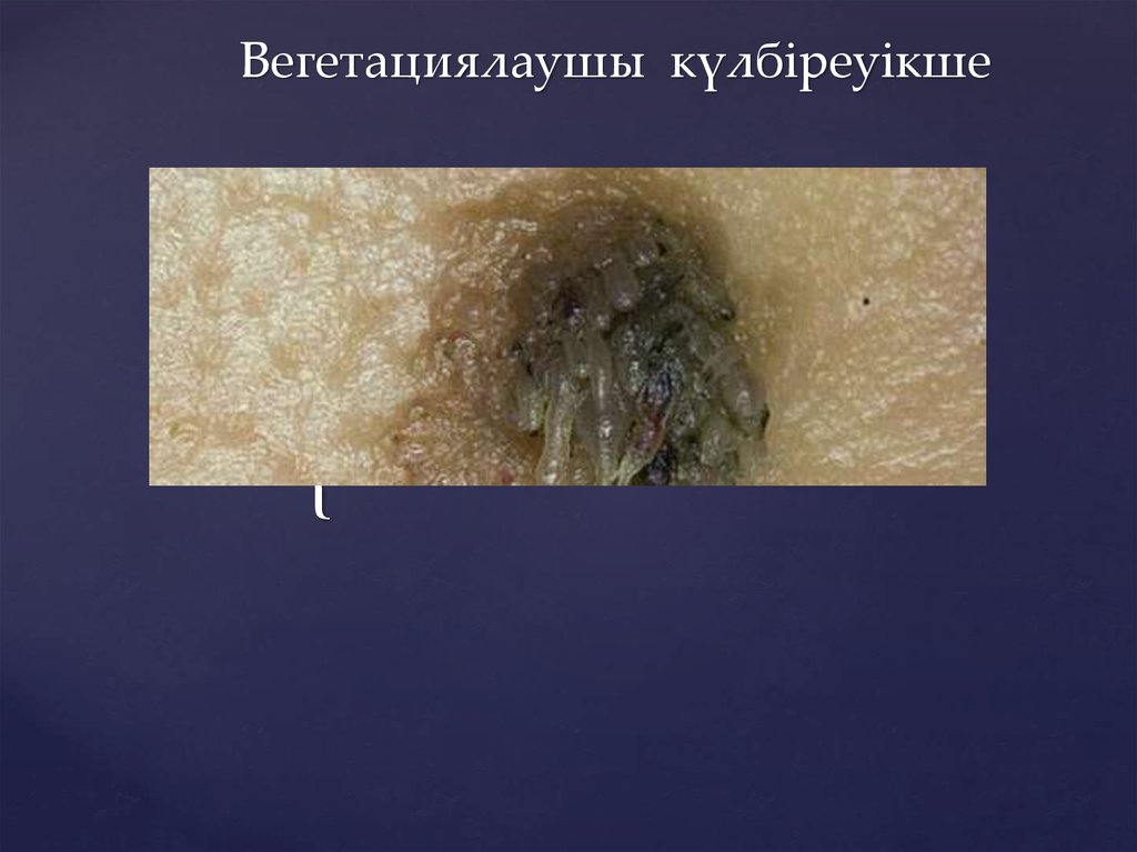 Вегетациялаушы күлбіреуікше