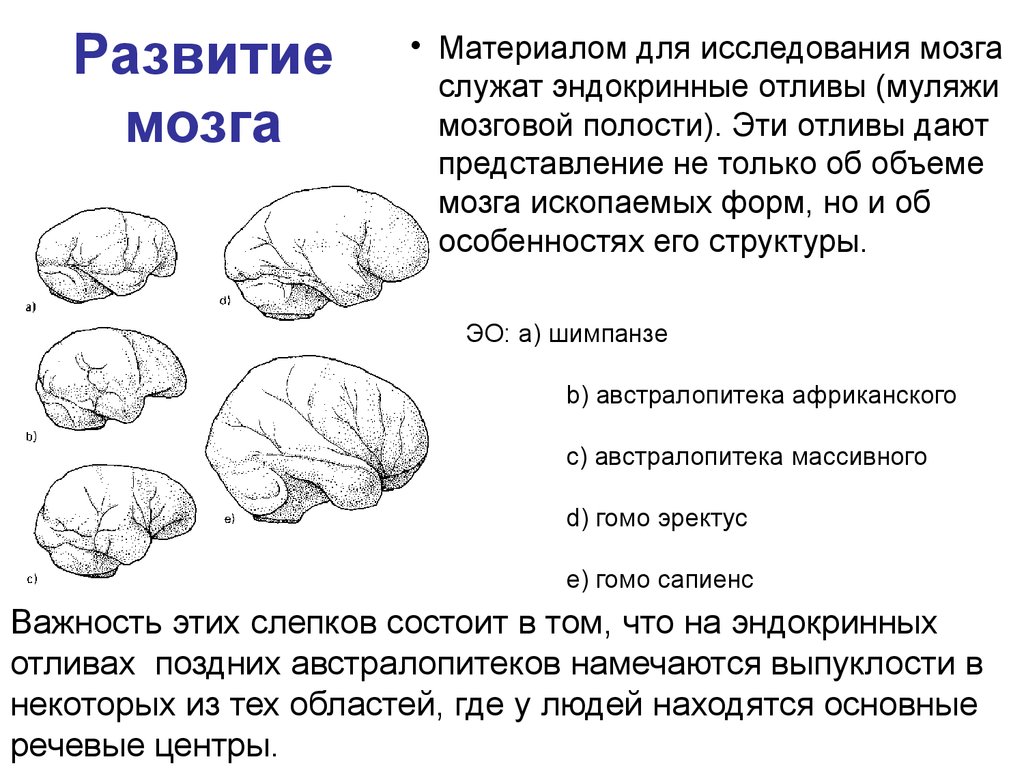Brain 144