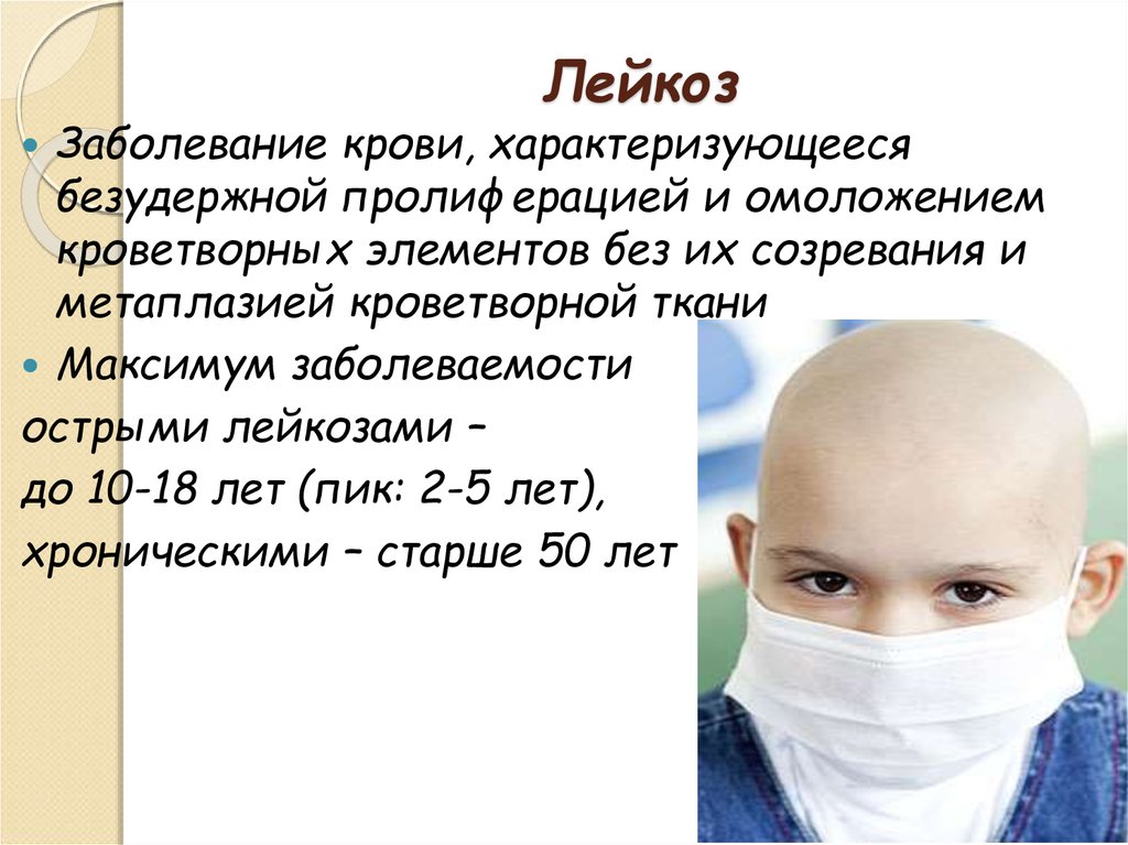 Причины лейкоза у детей. Заболевание белокровие. Острый лейкоз (лейкемия).