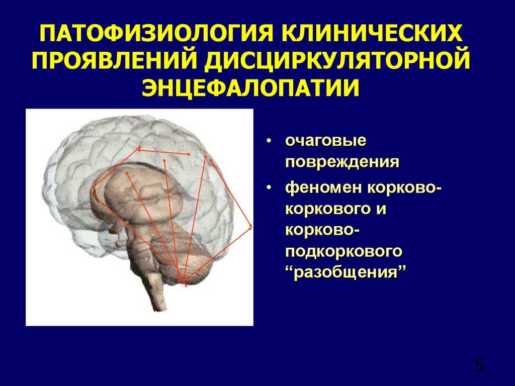 Дисциркуляторной энцефалопатии головного мозга у взрослых что