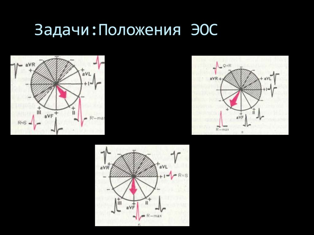 Как выглядит ЭОС. Если ЭОС В - 60.