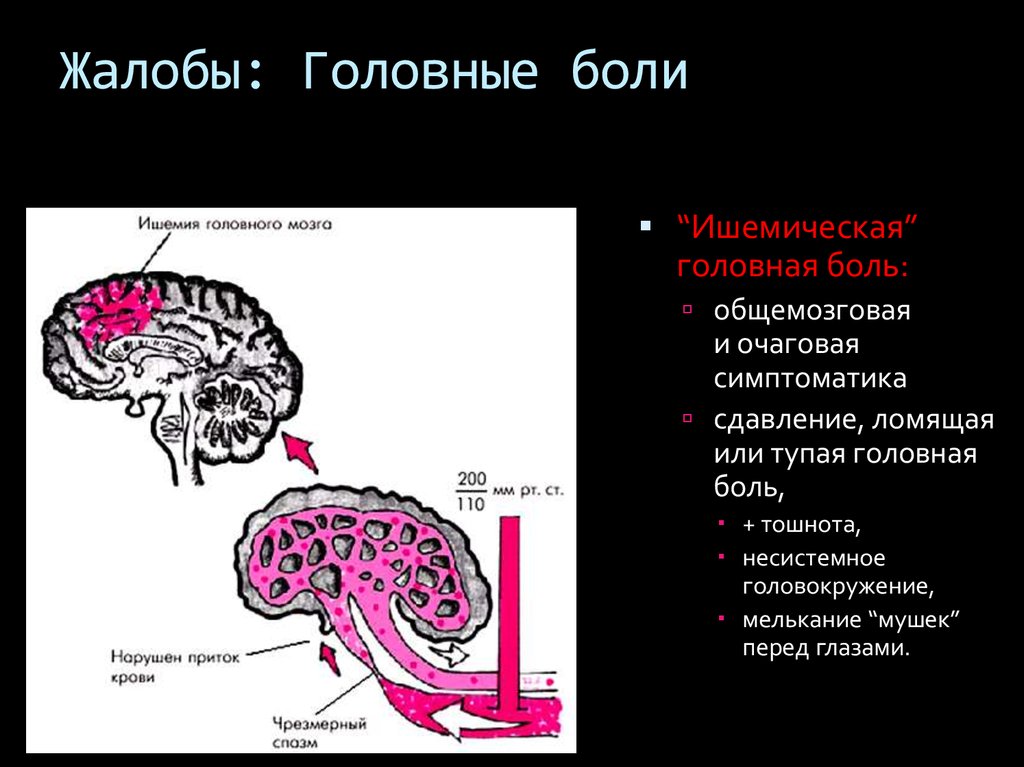 Ишемия головы