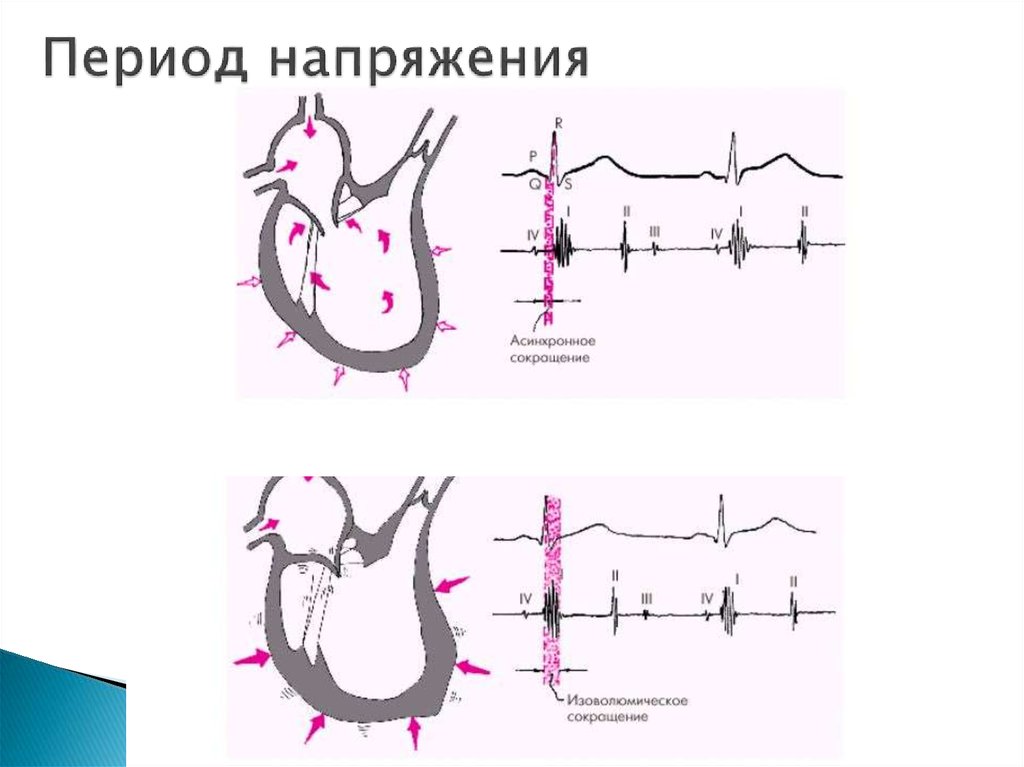 Период напряжения