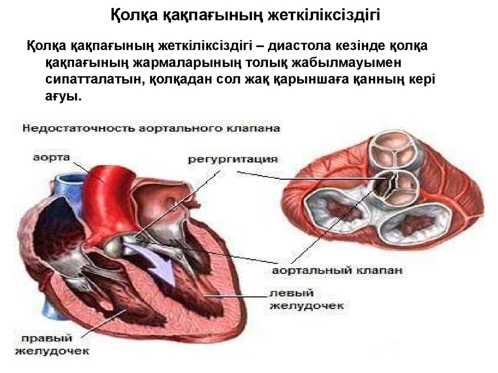 Өкпе жүрек жетіспеушілігі презентация