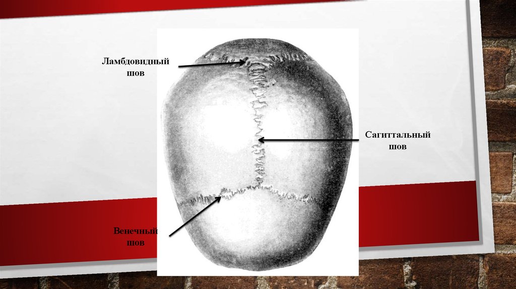 Ламбдовидный шов. Венечный Сагиттальный ламбдовидный шов. Лчмдоаиднвй шов черепа. Венечный Сагиттальный и ламбдовидный швы черепа. Венечный ламбовиднвй и сашитальный шов череп.