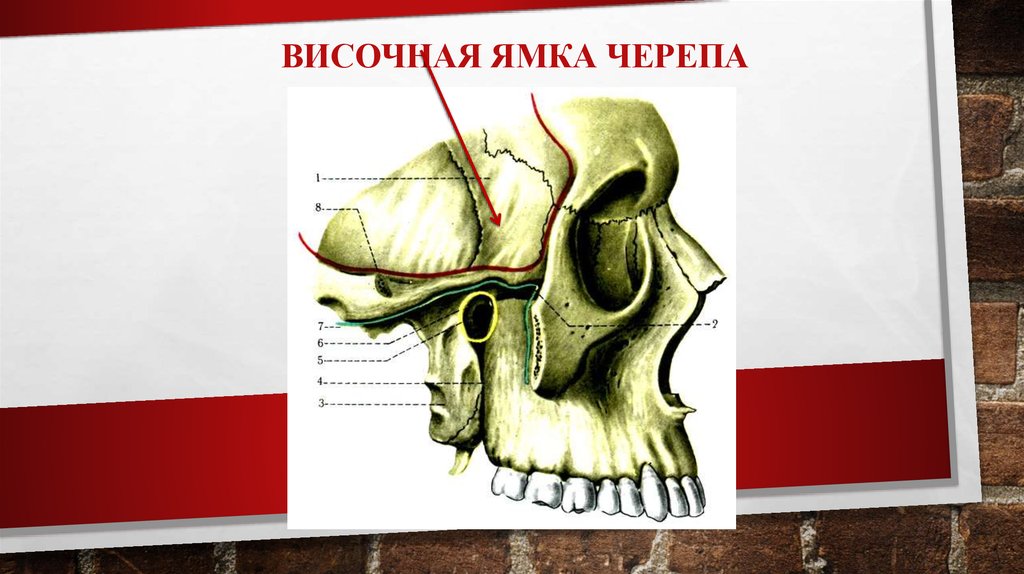 Крылонебная ямка сообщается. Подвисочная ямка анатомия. Подвисочная ямка черепа. Височная и подвисочная ямка. Ямки височная подвисочная крылонебная.