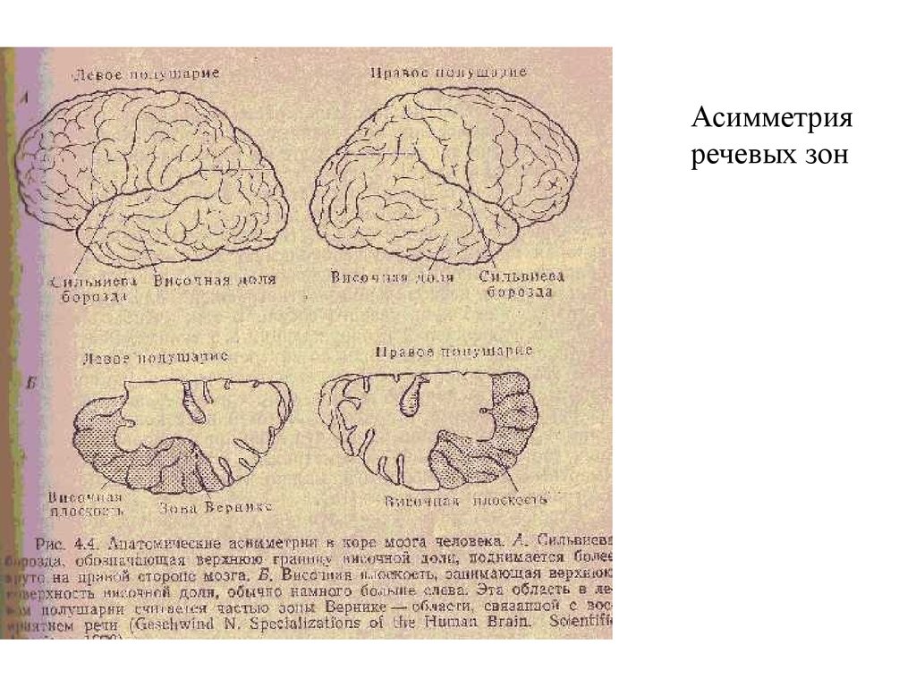 Асимметрия мозга презентация