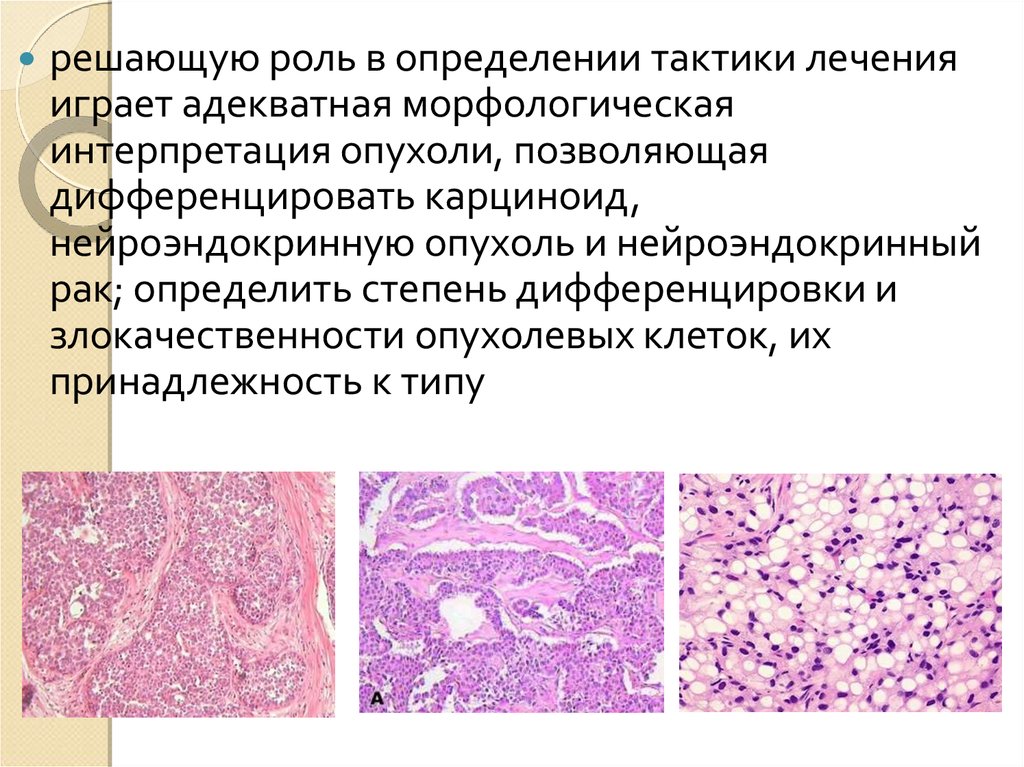 Лечение карциноида - презентация онлайн