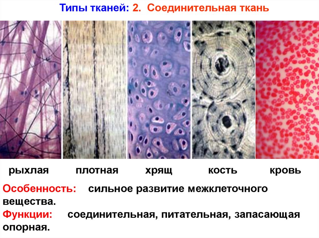 Названия тканей человека. Соединительные ткани хрящ межклеточное вещество. Тип клеток соединительной ткани хряща. Соединительная ткань хрящевая межклеточное вещество клетка. Типы тканей соединительная ткань.