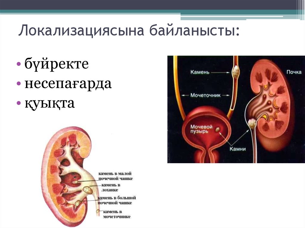 Локализациясына байланысты: