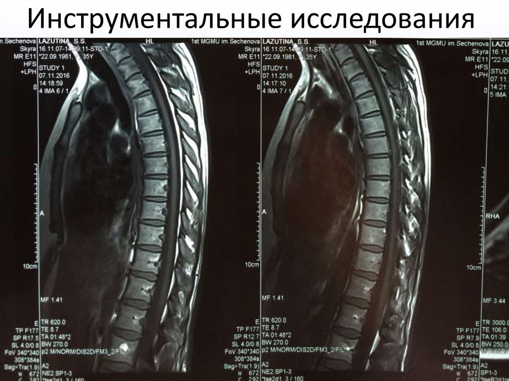 Инструментальные исследования