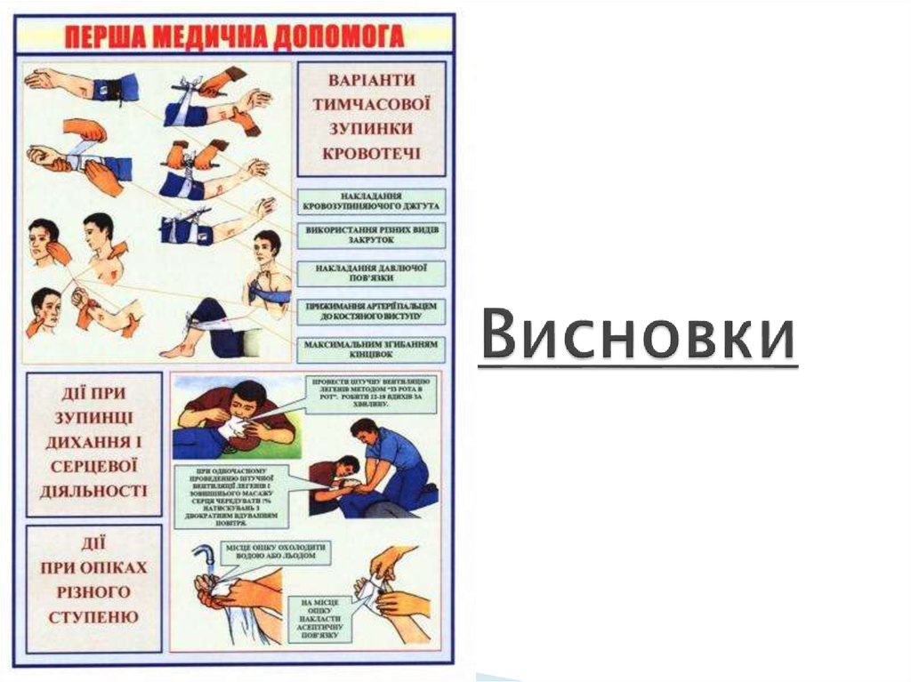 Висновки