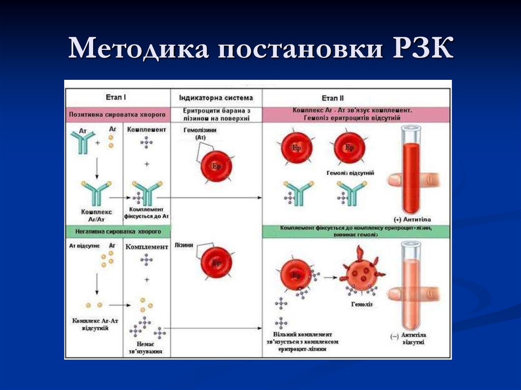 Метод постановки