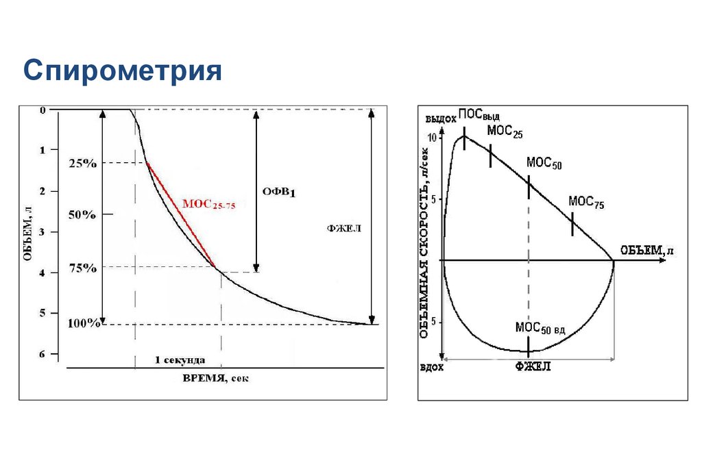 Спирометрия что это. Нормальный график спирометрии. Спирометрия графики норма. Показатели функции внешнего дыхания при ХОБЛ. График спирометрии при бронхиальной астме.