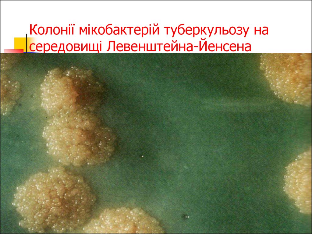 Колонії мікобактерій туберкульозу на середовищі Левенштейна-Йенсена