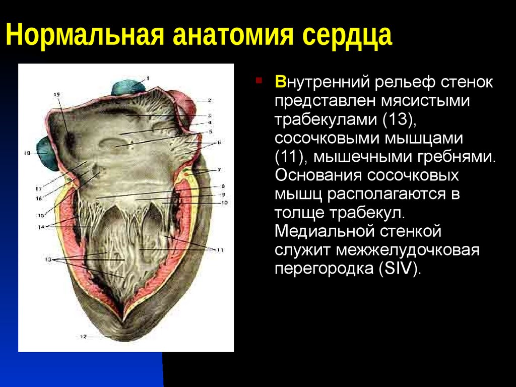 Правый желудочек функции. Анатомия клапанов сердца сосочковые мышцы. Рельеф внутренних поверхностей камер сердца. Внутренняя поверхность правого желудочка. Сосочковые мышцы правого желудочка.
