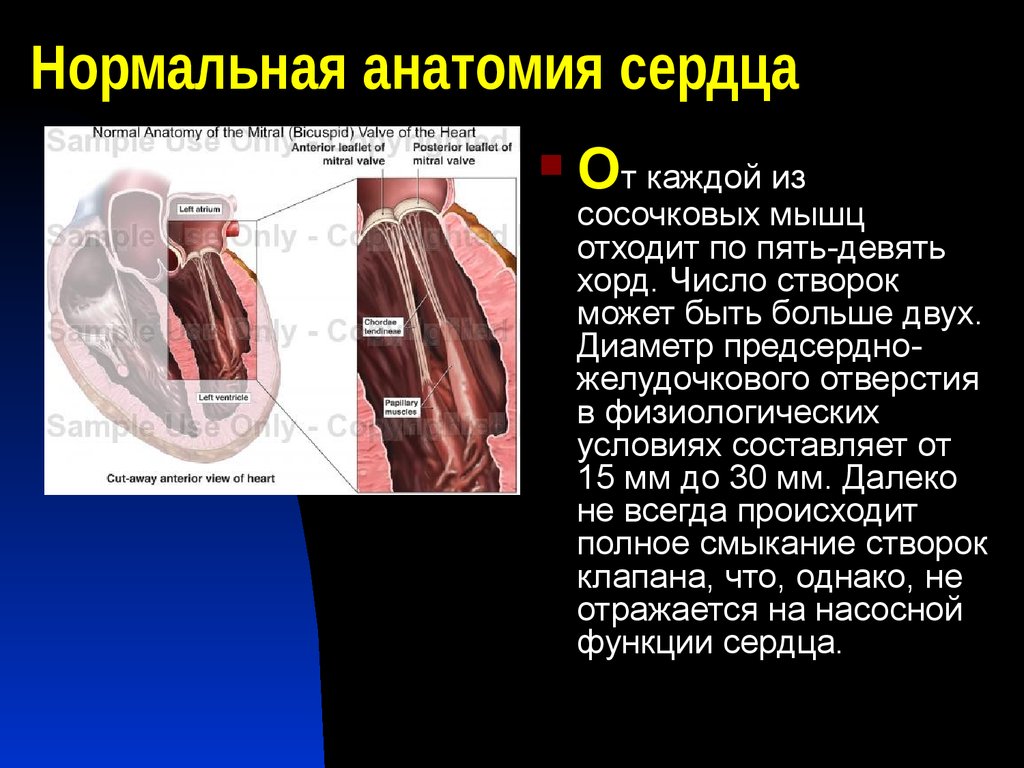 Нормальная анатомия сердца видео институт Сеченова.