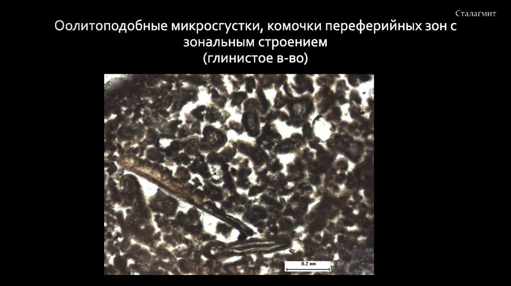 Оолитоподобные микросгустки, комочки переферийных зон с зональным строением (глинистое в-во)