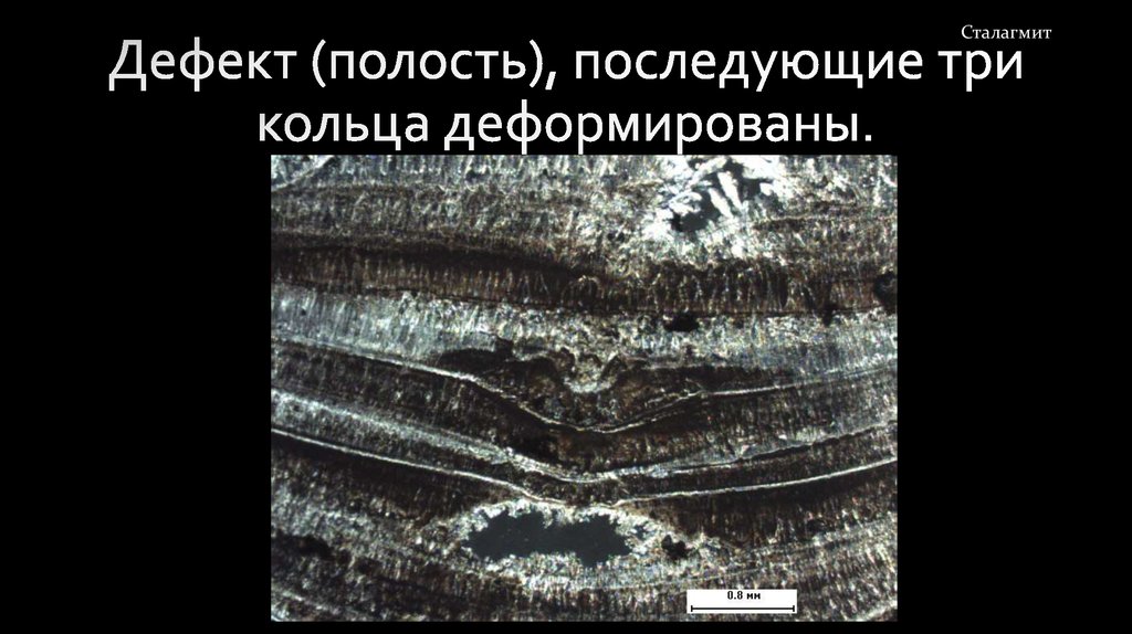 Дефект (полость), последующие три кольца деформированы.