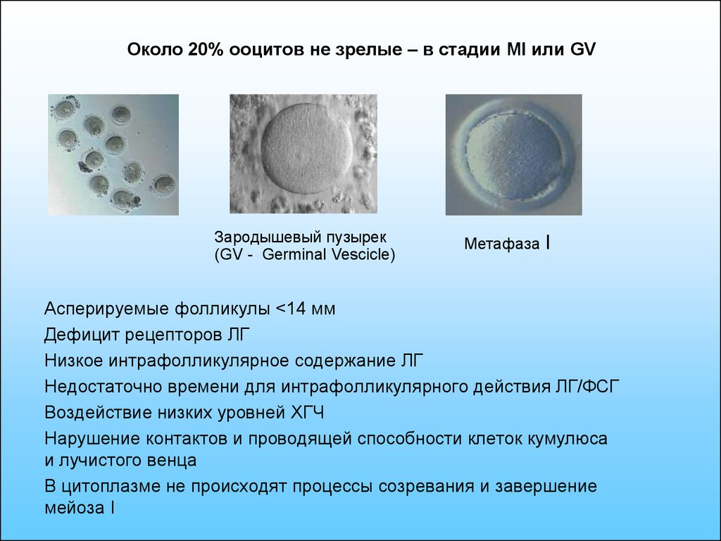 Ооциты. Качество яйцеклеток. Качество яйцеклеток при эко. Ооцит-кумулюсных комплексов. Оценка качества ооцитов.