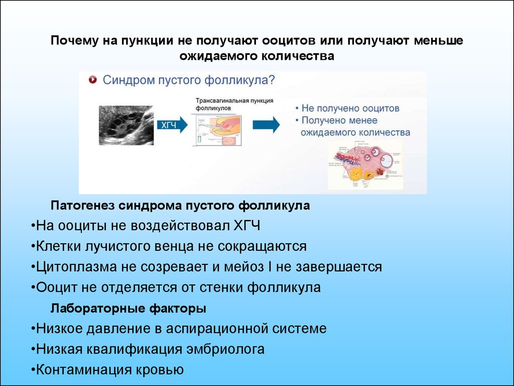 Ооциты качество. Оценка ооцита. Качество ооцитов. Синдром пустых фолликулов. Оценка качества ооцитов.