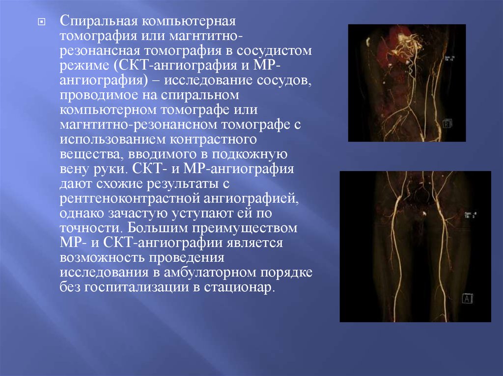 Исследование артерий. Спиральная ангиография сосудов. Ангиография верхних конечностей. Контрастными средствами при проведении кт-ангиографии являются. Ангиография заключение.