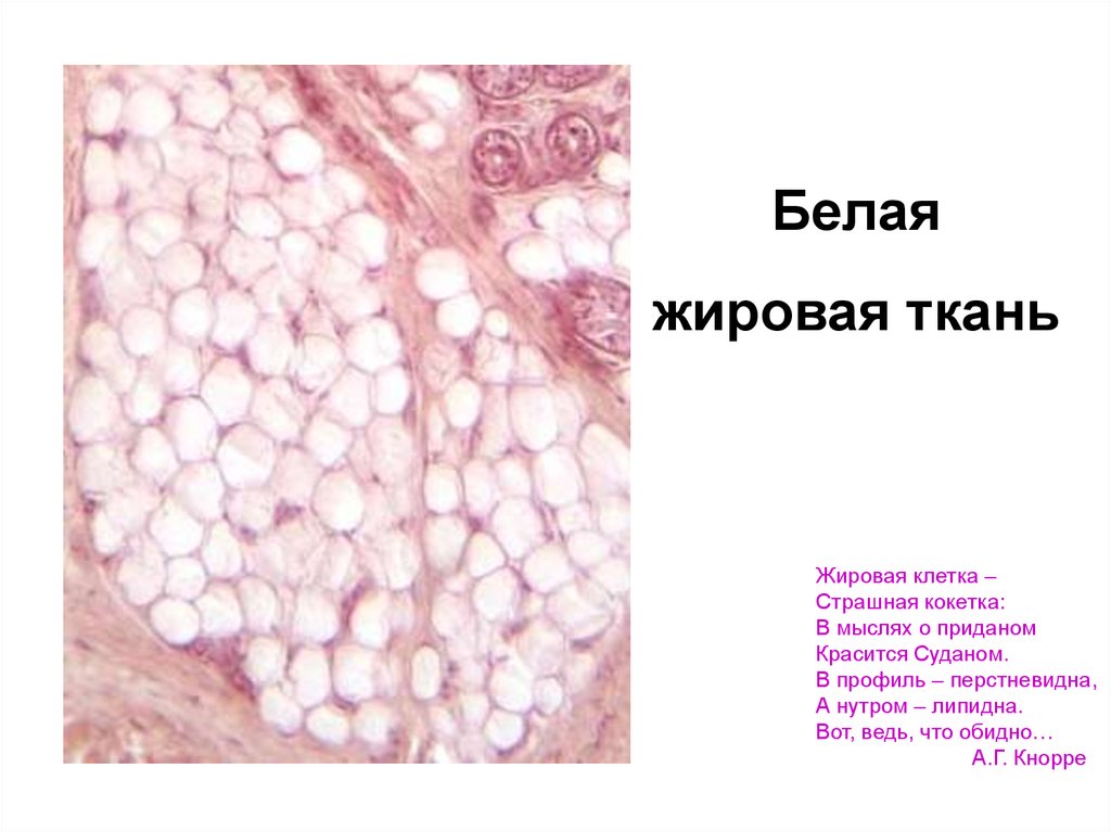 Запасает жировую ткань. Белая жировая ткань. Бурая жировая ткань гистология. Выявление жировой ткани гистология.