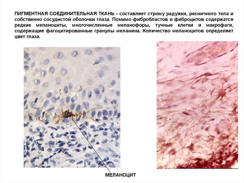 Ответ соединительная ткань соединительная. Пигментная ткань это соединительная ткань. Пигментные клетки соединительной ткани. Фибробласты соединительной ткани. Пигментные клетки в рыхлой соединительной ткани.