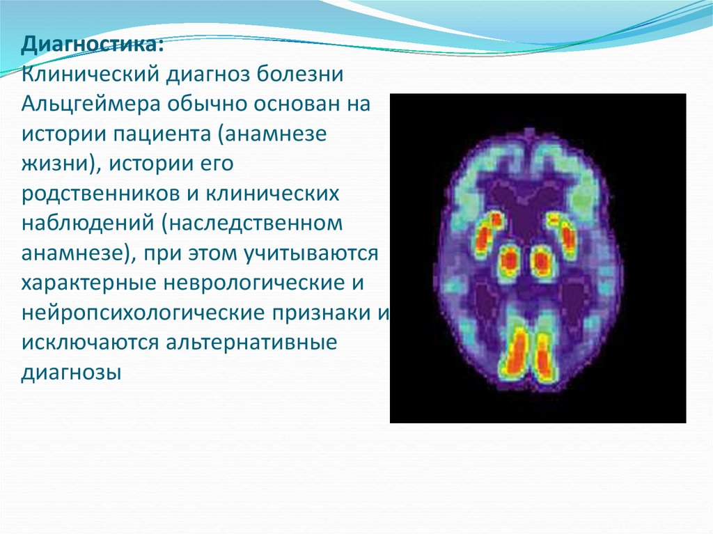 Диагностика: Клинический диагноз болезни Альцгеймера обычно основан на истории пациента (анамнезе жизни), истории его родственников и кли