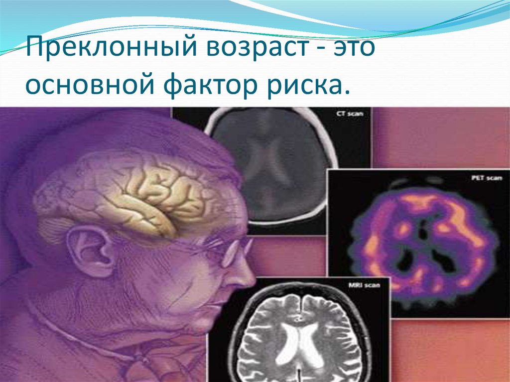 Преклонный возраст - это основной фактор риска.