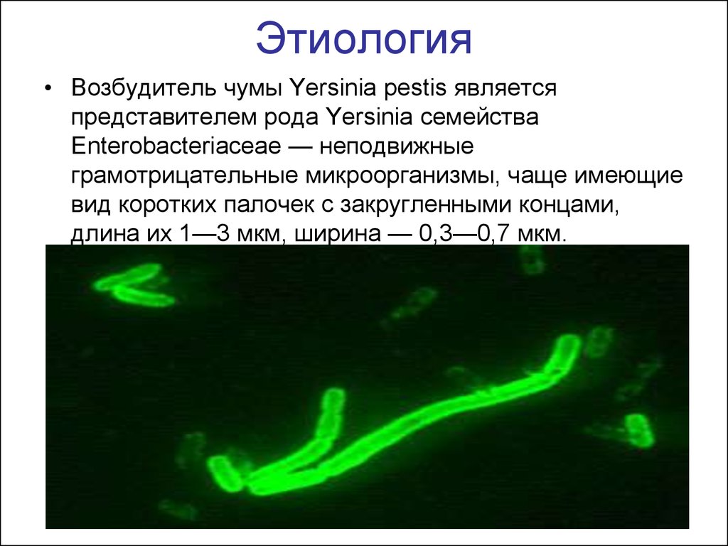 Чума холера сибирская язва. Строение Чумной палочки. Возбудитель чумы является.