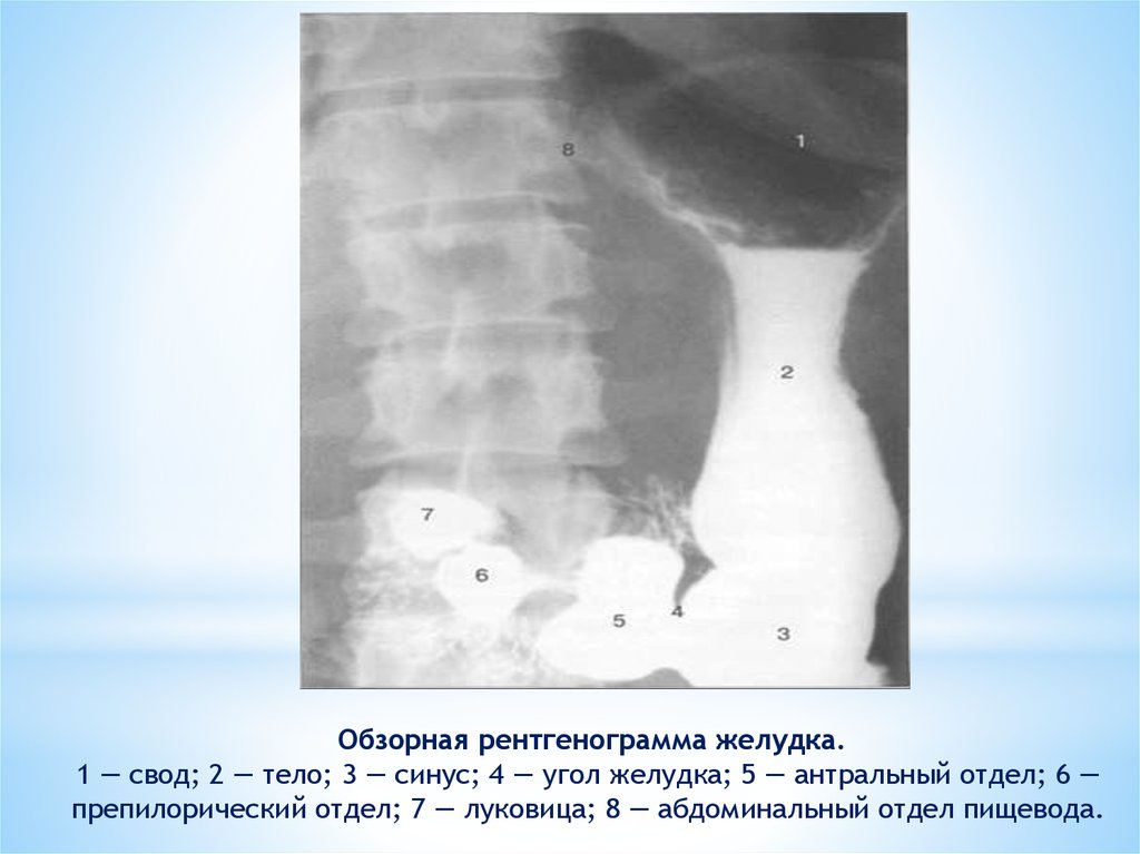 Рентгенография желудка презентация