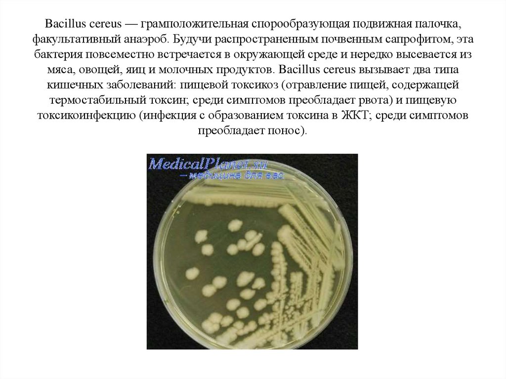 Образующие споры. Bacillus Cereus жгутики. Бактерий Bacillus Cereus. Bacillus Cereus (пищевая токсикоинфекция).. Bacillus Cereus микробиология характеристика.