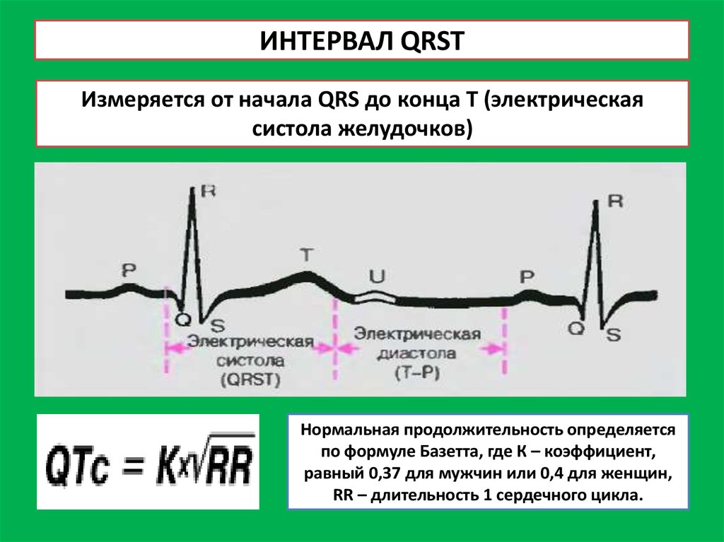 Qrs на экг что это. Систола желудочков на кардиограмме. Интервал QRS на ЭКГ норма. Электрическая систола ЭКГ норма. QRS норма ЭКГ.