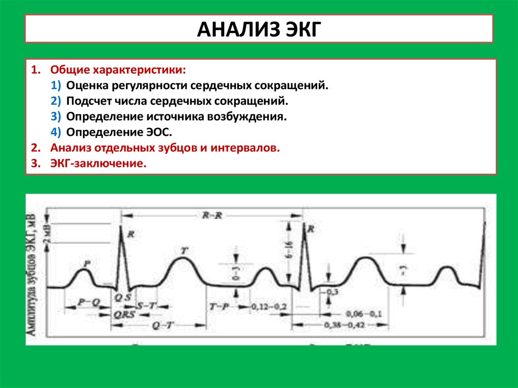 Анализ экг. ЭКГ расшифровка зубцов и интервалов. Анализируемые параметры ЭКГ. Схема нормальной ЭКГ. Анализ зубцов ЭКГ.