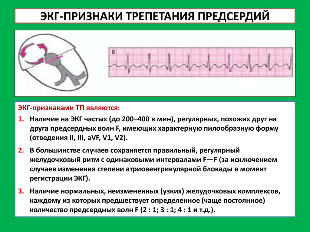 План описания экг