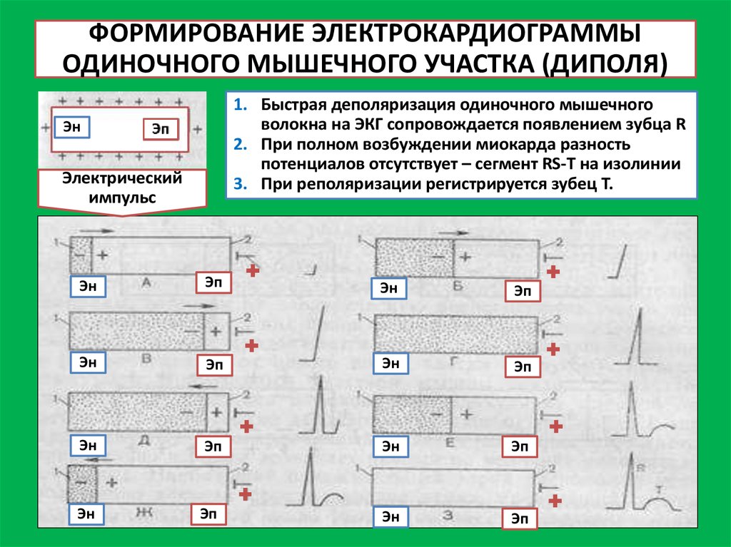 План расшифровки экг