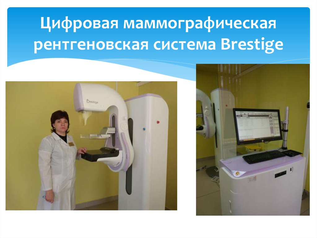Цифровая маммографическая рентгеновская система Brestige