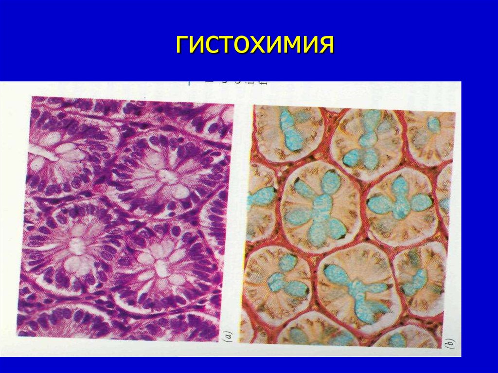 Гистохимические методы исследования презентация