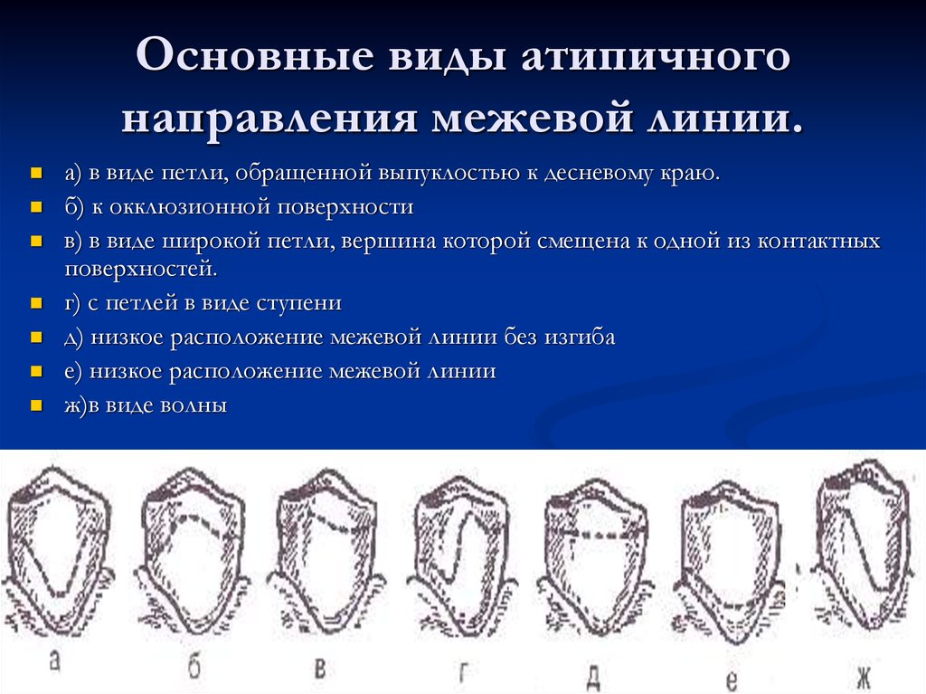 Виды направляющих линий. Межевая линия. Виды расположения Межевой линии. Типы межевых линий. Топография Межевой линии.