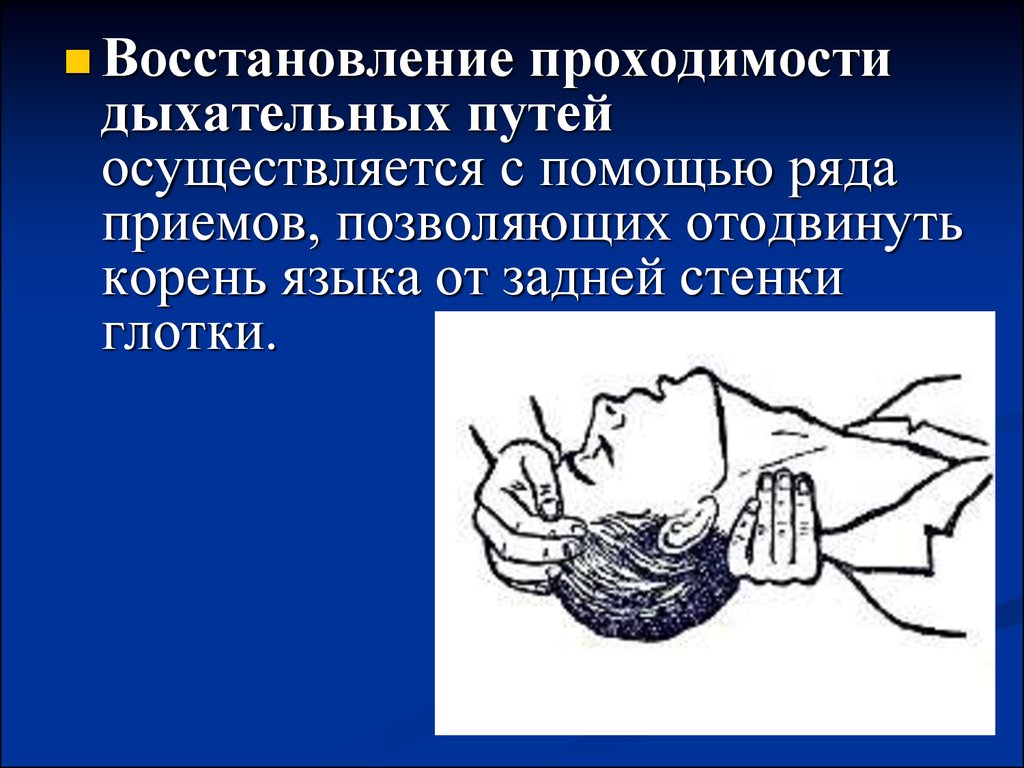 Восстановление дыхательных путей последовательность. Восстановление проходимости дыхательных путей. Восстановление проходимости дыхательных путей осуществляют. Приемы восстановления проходимости дыхательных путей. Восстановление проходимости дых путей.