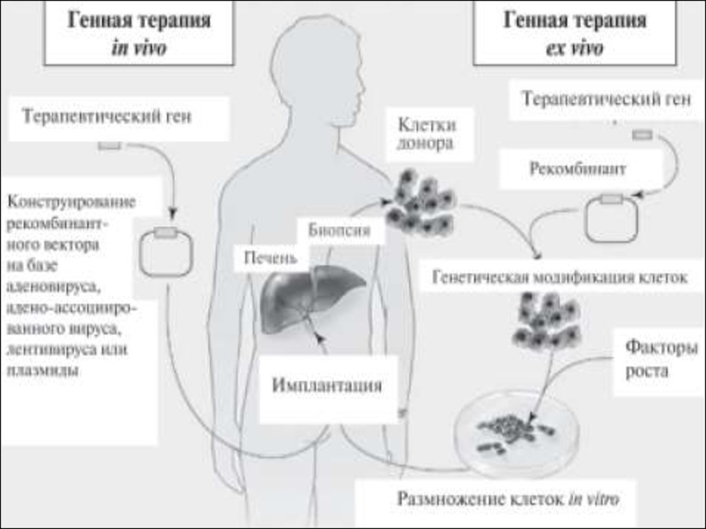 Генная терапия. Схема проведения генной терапии. Схемы генной терапии in vivo и ex vivo. Генная терапия схема. Генная терапия наследственных заболеваний in vivo in.